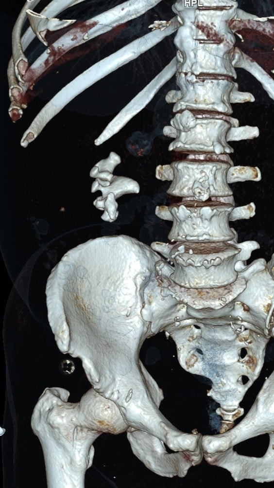 terebolia_hirurhia2.jpg