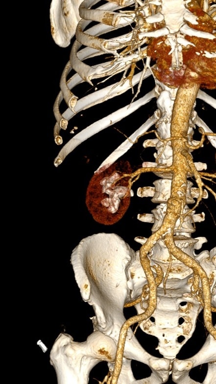 terebolia_hirurhia3.jpg