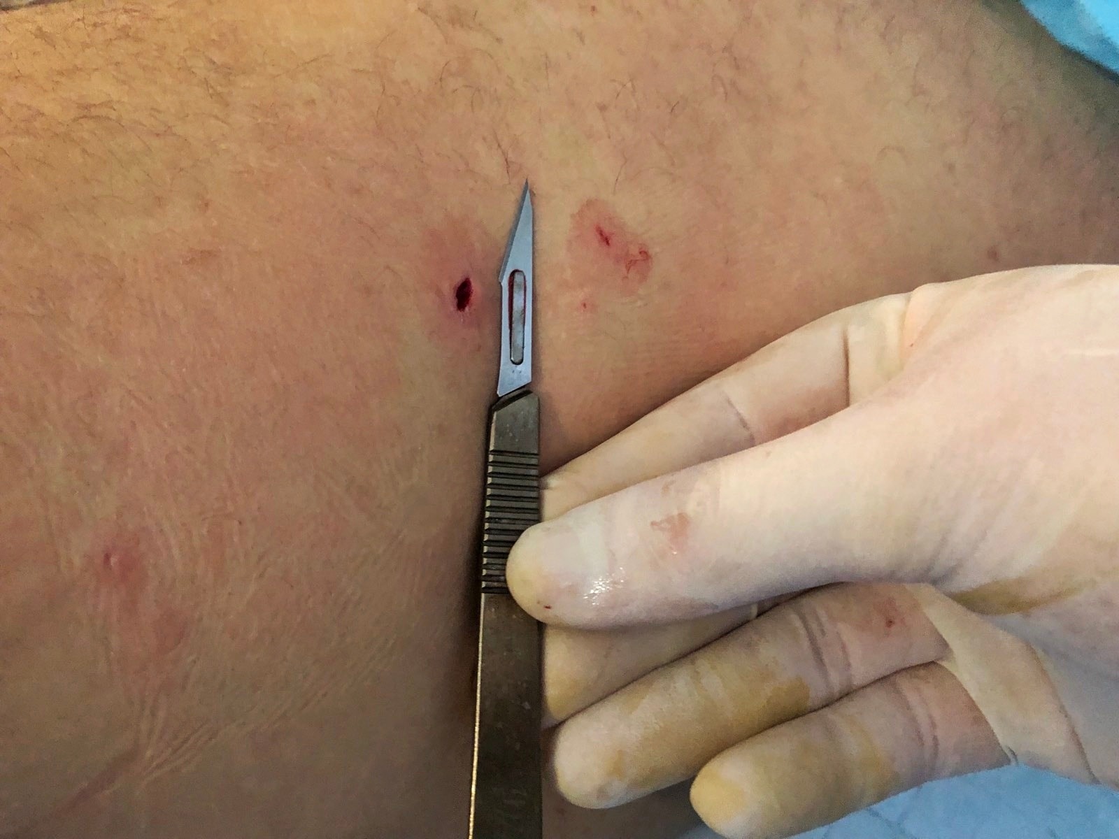 terebolia_hirurhia4.jpg